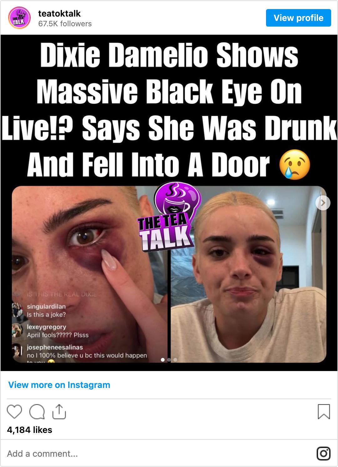 recovered instagram C5PleVZrwi3